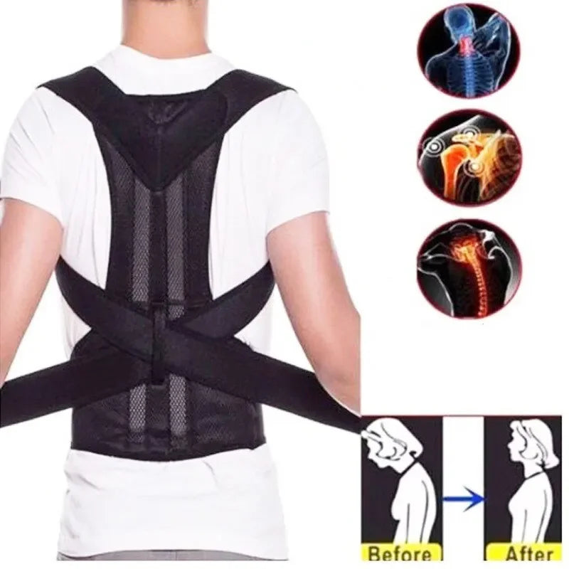 Adjustable Back Posture Corrector